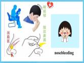 人教版2019选择性必修第二册 高二英语 Unit 5《FIRST AID》Reading And Thinking 课件