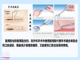 鲁科版选择性必修3 微项目  探秘神奇的医用胶 课件