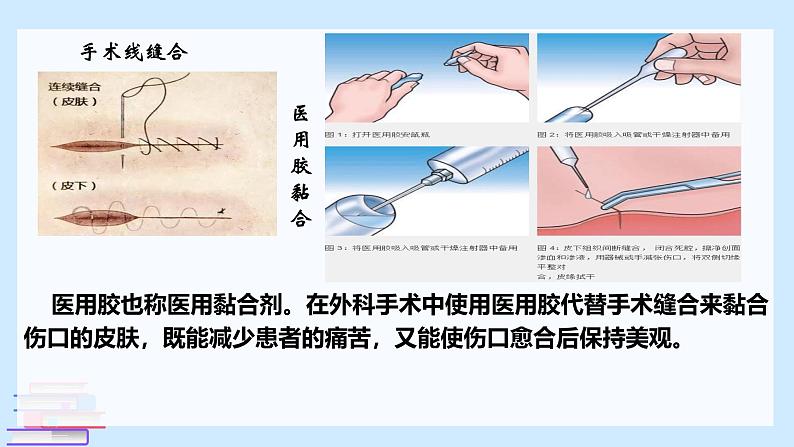 鲁科版选择性必修3 微项目  探秘神奇的医用胶 课件第3页