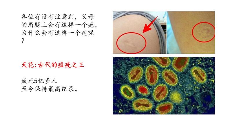 第14课 历史上的疫病与医学成就课件--2022-2023学年高中历史统编版选择性必修二06