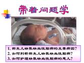 《儿科护理》第6章 第1节 课件 新生儿缺氧缺血性脑病的护理