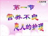 《儿科护理》第7章 第1节 小儿营养不良患儿的护理  课件