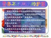 《儿科护理》第7章 第1节 小儿营养不良患儿的护理  课件