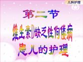 《儿科护理》第7章 第2节  维生素D缺乏性佝偻病患儿的护理 课件