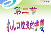 第9章-第2节 小儿口腔炎的护理 课件