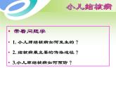 《儿科护理》第14章 第1节 小儿结核病概述 课件