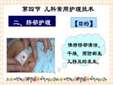 第4章 第4节 儿科常用护理技术(2)实践四 脐部护理 课件