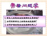 第6章 第1节 新生儿缺氧缺血性脑病的护理课件+学案