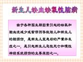 第6章 第1节 新生儿缺氧缺血性脑病的护理课件+学案
