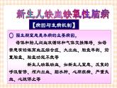 第6章 第1节 新生儿缺氧缺血性脑病的护理课件+学案