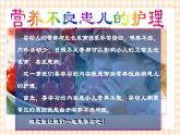 第7章 第1节 小儿营养不良患儿的护理  课件+学案