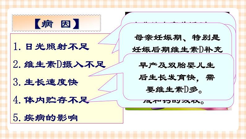 第7章 第2节  维生素D缺乏性佝偻病患儿的护理 课件+学案07