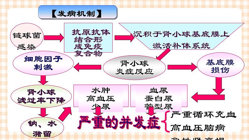 第12章-第2节 急性肾小球肾炎患儿的护理 课件+学案06