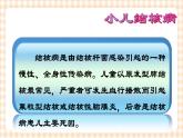 第14章 第1节 小儿结核病概述 课件+学案