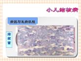 第14章 第1节 小儿结核病概述 课件+学案