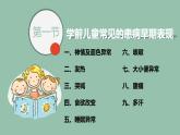 第五章  学前儿童生理疾病的预防与护理课件PPT