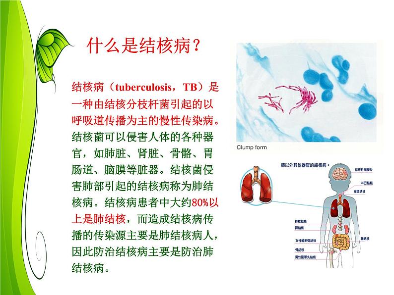 学校结核病预防与控制知识培训课件PPT第6页