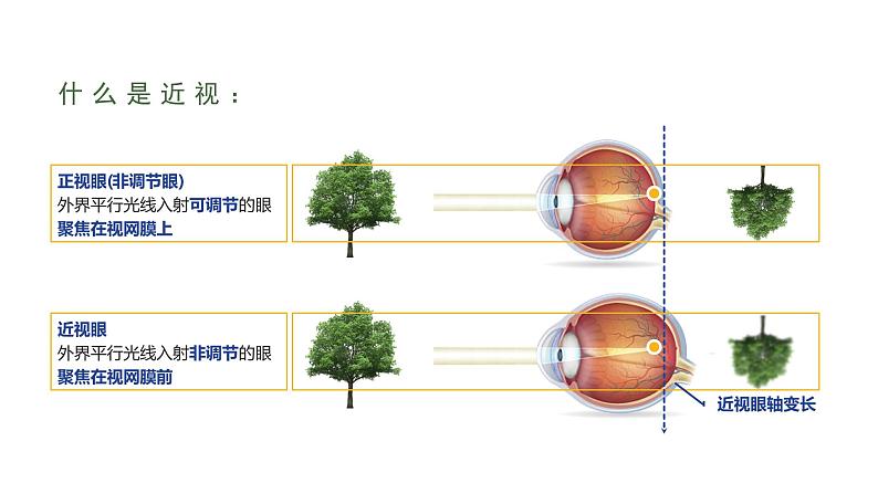 近视防控主题班会课件PPT第6页