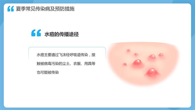 蓝色卡通儿童夏季传染病预防PPT模板第7页