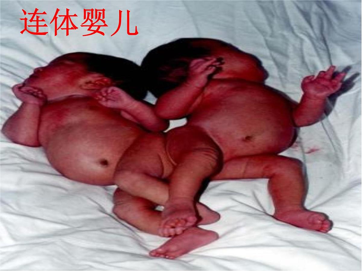 黑龙江省哈尔滨市依兰县达连河镇初级中学-主题班会-珍惜生命 健康成长【课件】第8页