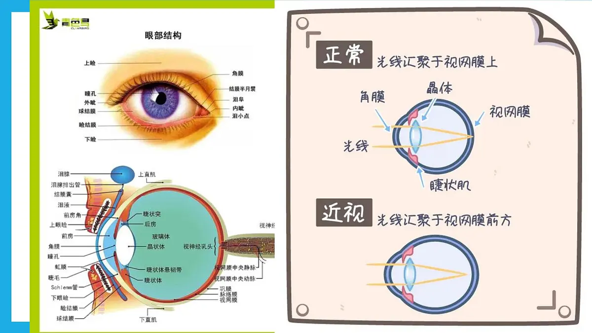 爱眼一小步，健康一大步——全国爱眼日主题班会课件第6页