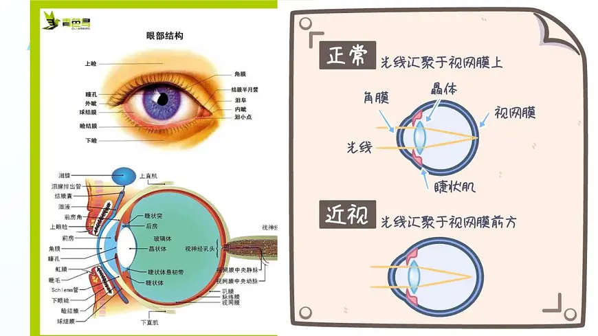 小小眼睛，大大世界——保护眼睛，预防近视爱眼日主题班会课件第8页