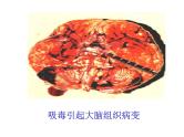 主题班会：远离毒品，珍爱生命PPT课件