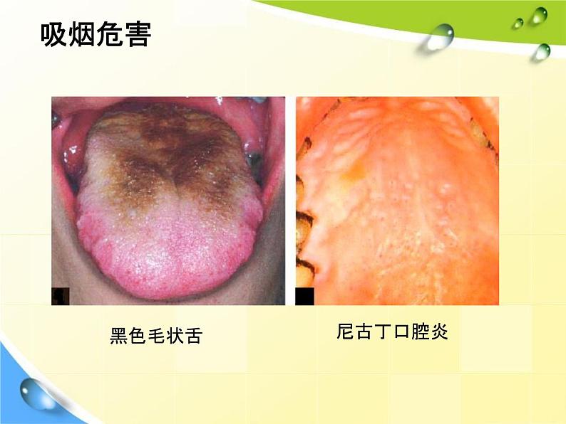 通用版主题班会《校园安全教育》精品教学课件PPT优秀课件607
