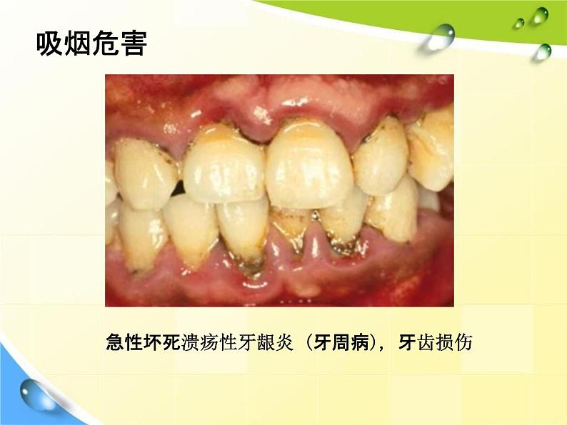 通用版主题班会《校园安全教育》精品教学课件PPT优秀课件608