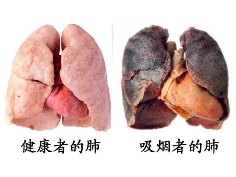 拒绝吸烟—主题班会活动课件07