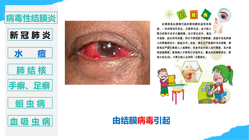 【核心素养】人教版初中生物八年级上册4.7.1《传染病及其预防》课件第8页