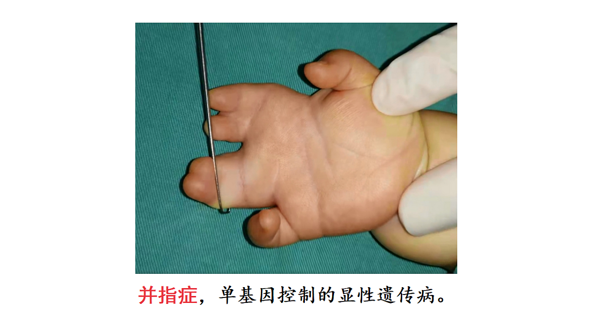 17557247第3页