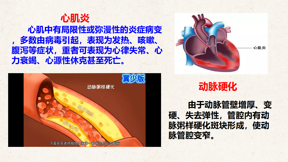 冀少版七年级生物下册教学课件《2.3 心脏和血管的保护》第7页